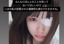 凉宫琴音：就算是这样，我也很努力地活着。【EV扑克下载】-德州扑克迷