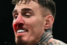 大发体育-UFC冠军汤姆将继续进行双眼手术,大发助力你的致富之路!-德州扑克迷