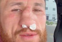 梅拉布·德瓦利什维利鼻骨两处骨折仍要打！放话硬刚亨利·塞胡多，大发体育助力你的致富之路！-德州扑克迷